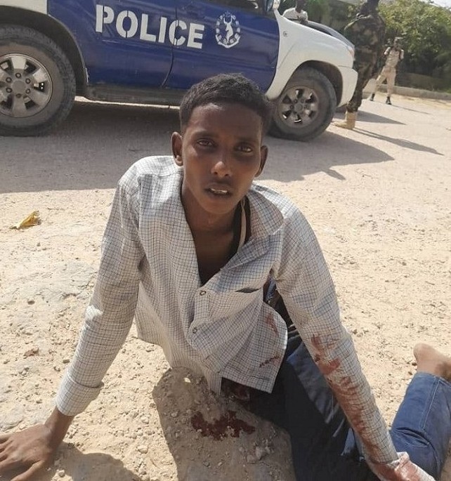 Ninka la qabtay oo dhaawac ah.jpg